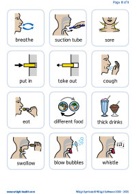 Tracheostomy flashcards 2